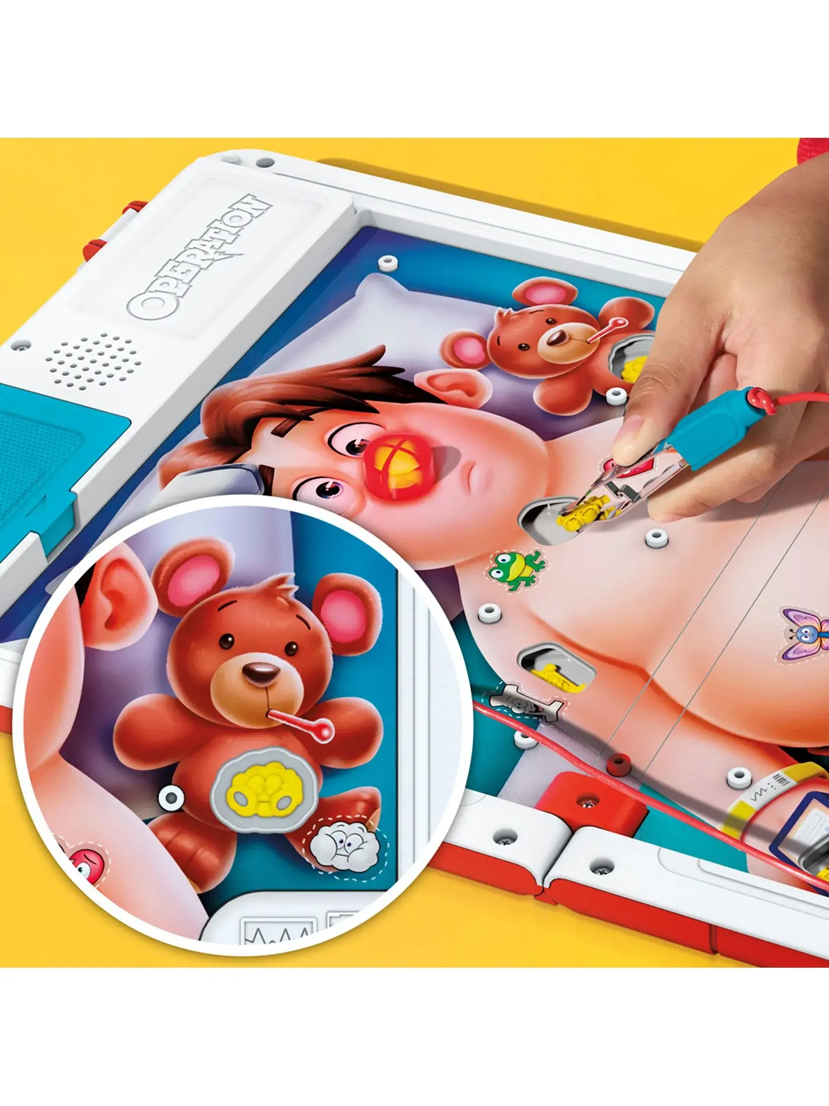 Hasbro Classic Operation Refresh